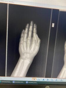 Justus, sein Cousin und die Omi gemeinsam im Urlaub in der Lüneburger Heide