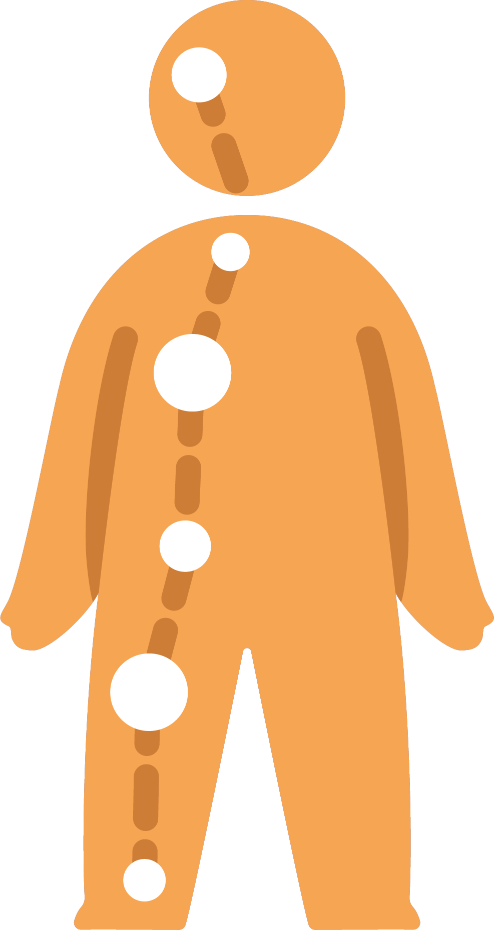 muskuläre Dysbalancen