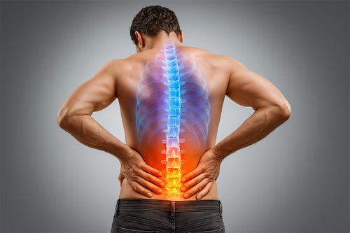 Was ist eine Subluxation