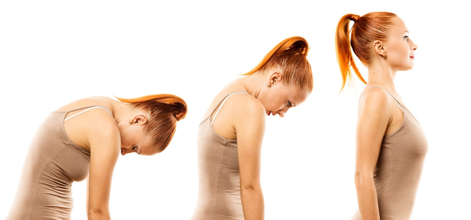 schlechte Körperhaltung